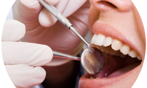 Fogászati állapotfelmérés